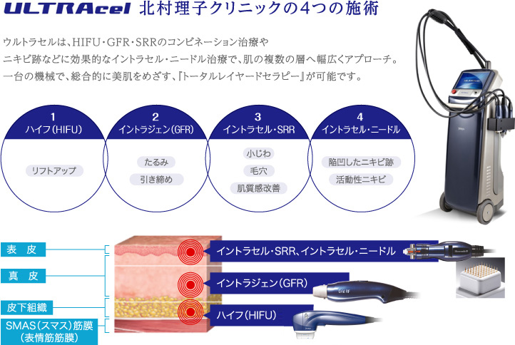 ULTRAcel北村理子クリニックの４つの施術