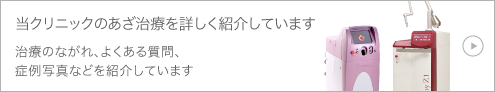 当クリニックのあざ治療を詳しく紹介しています